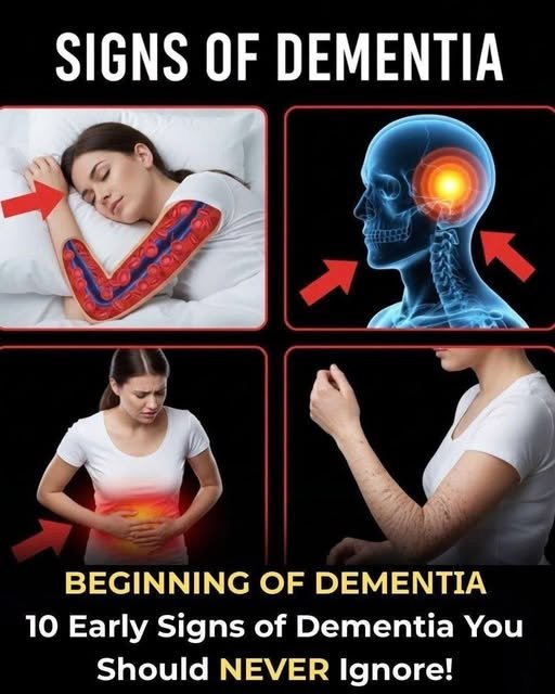 10 Early Signs of Dementia You Should Never Ignore 834019483_1613119563738298_3429480925239988657_n