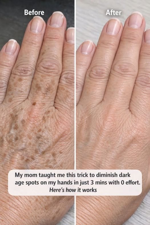 How to Reduce Age Spots on Your Hands: Simple Skincare Tips That May Help 839033118_122117047515476680_7357857559017860320_n