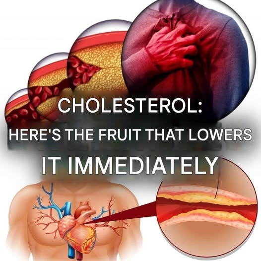 The Best Fruits for Heart Health: Can They Help Lower Cholesterol and Blood Pressure? image