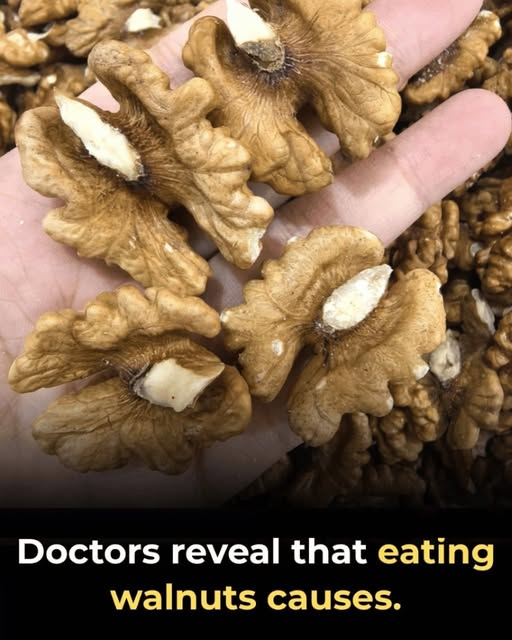 What Happens When You Eat Walnuts Every Day? 7 Potential Health Benefits image