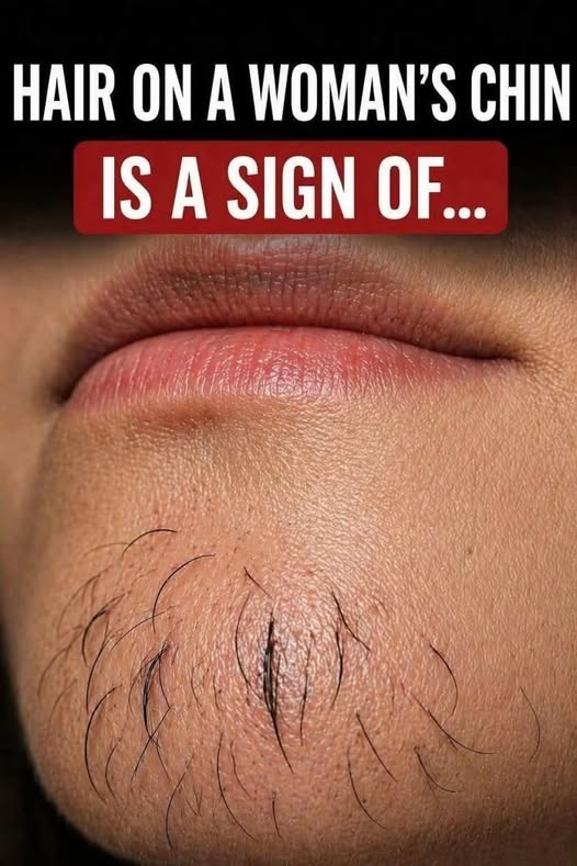 A Woman’s Chin Hair Could Be a Sign of More Than Just Aging: What Experts Want You to Know image