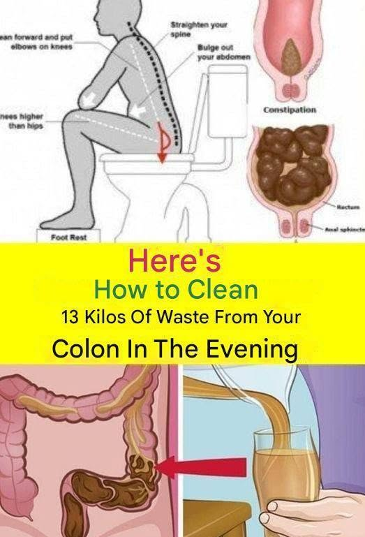 How to Support Colon Health Naturally: What Really Helps With Constipation? image